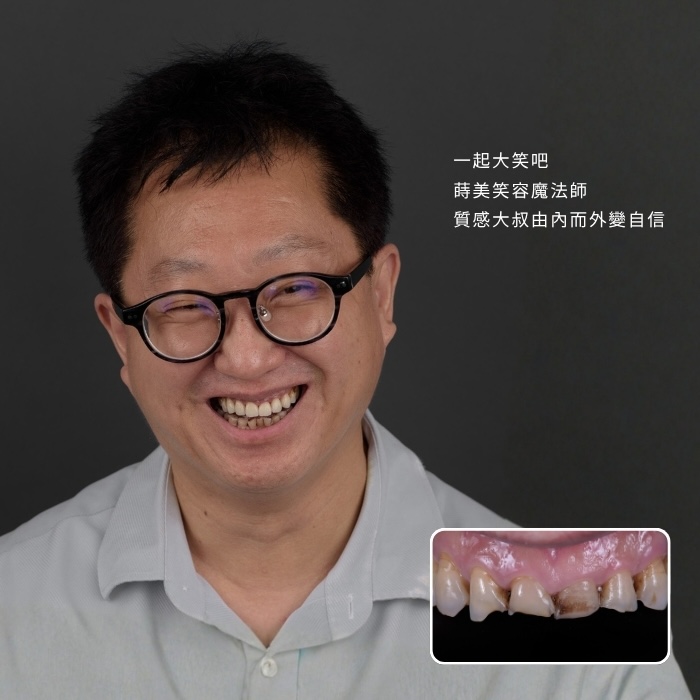 一起大笑吧！蒔美笑容魔法師，質感大叔由內而外變自信
