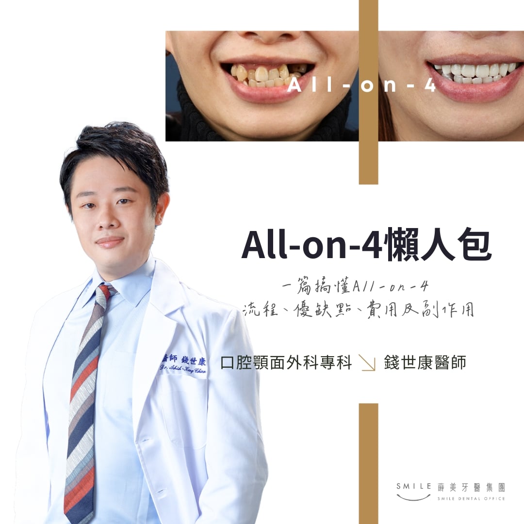 All-on-4懶人包