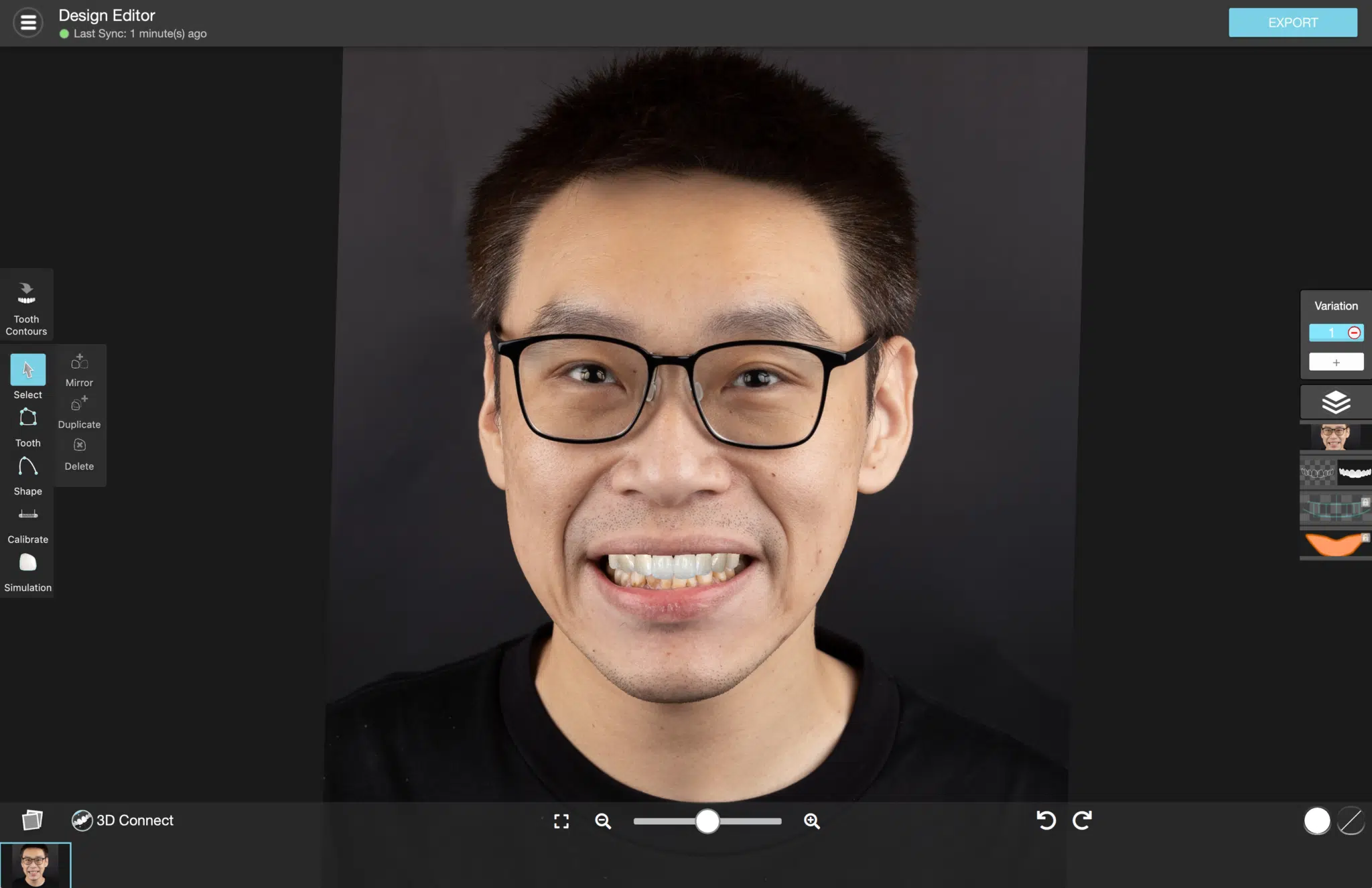 digital smile design