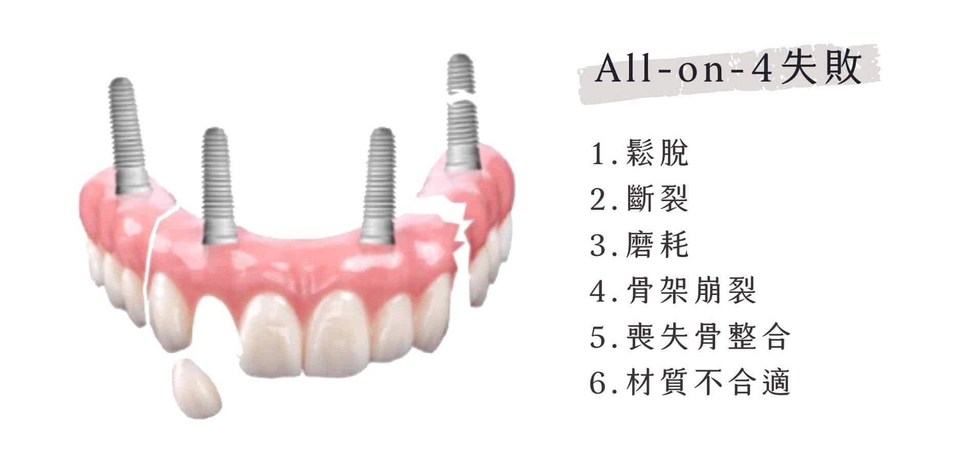 鬆脫 斷裂 磨耗 骨架崩裂 喪失骨整合 材質不合適