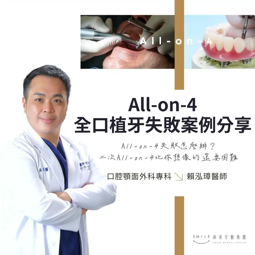 All-on-4全口植牙失敗案例分享