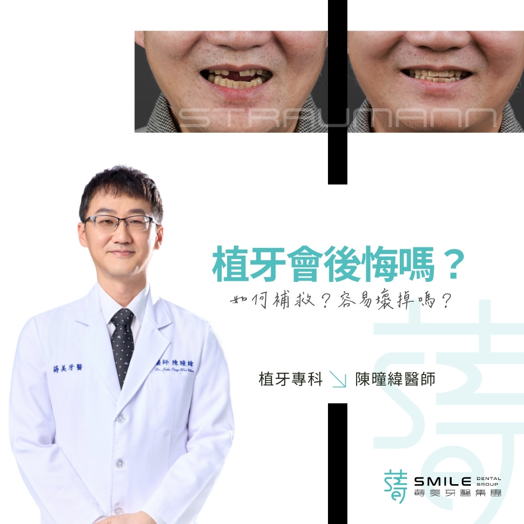 植牙會後悔嗎？