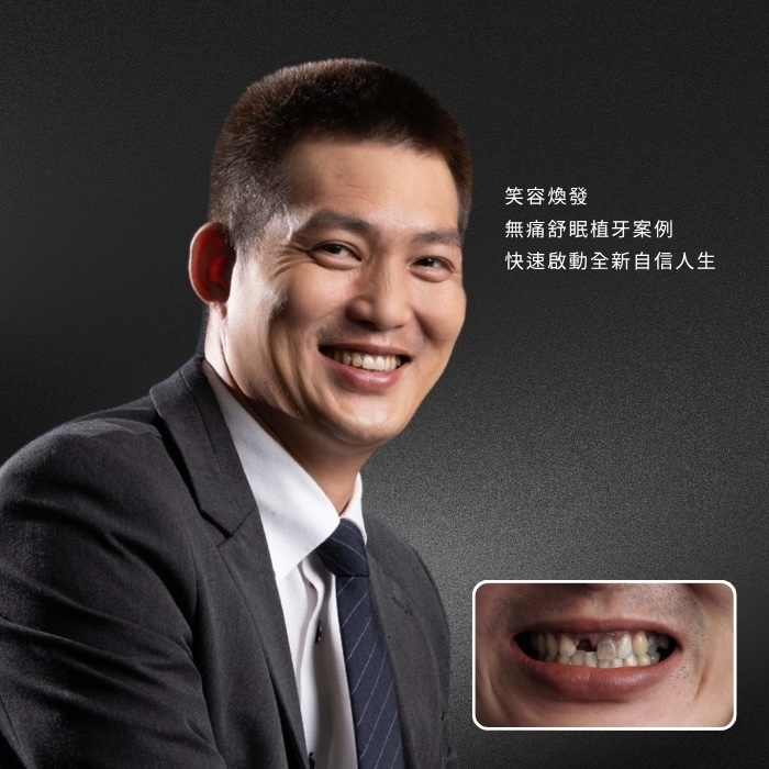 笑容煥發！無痛舒眠植牙案例快速啟動全新自信人生