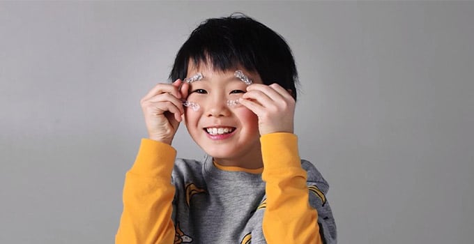 兒童隱適美的優點與缺點3