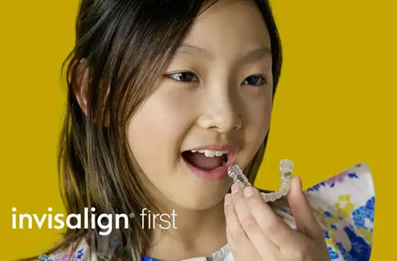 invisalign-first-kids