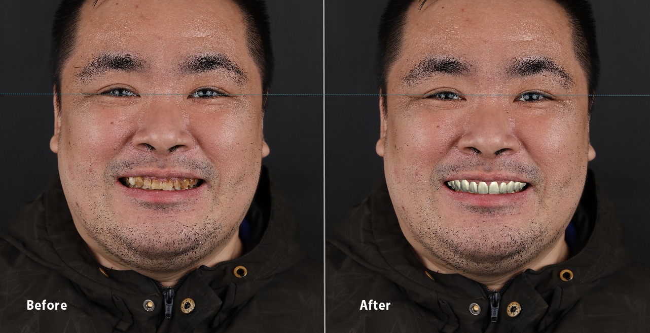 DSD b&a