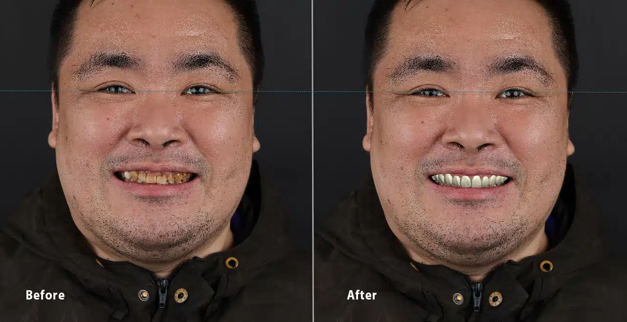 DSD b&a