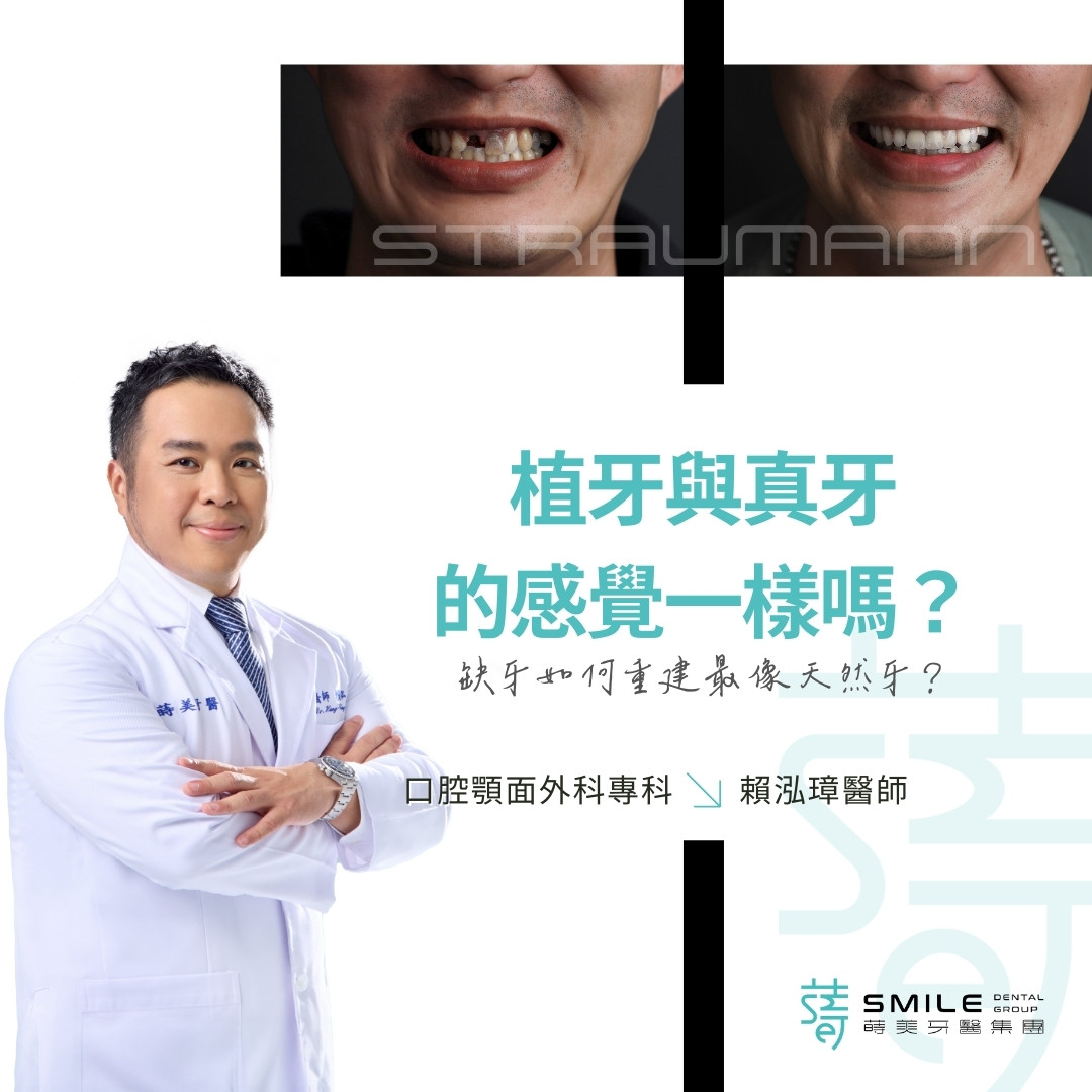 植牙與真牙 的感覺一樣嗎？