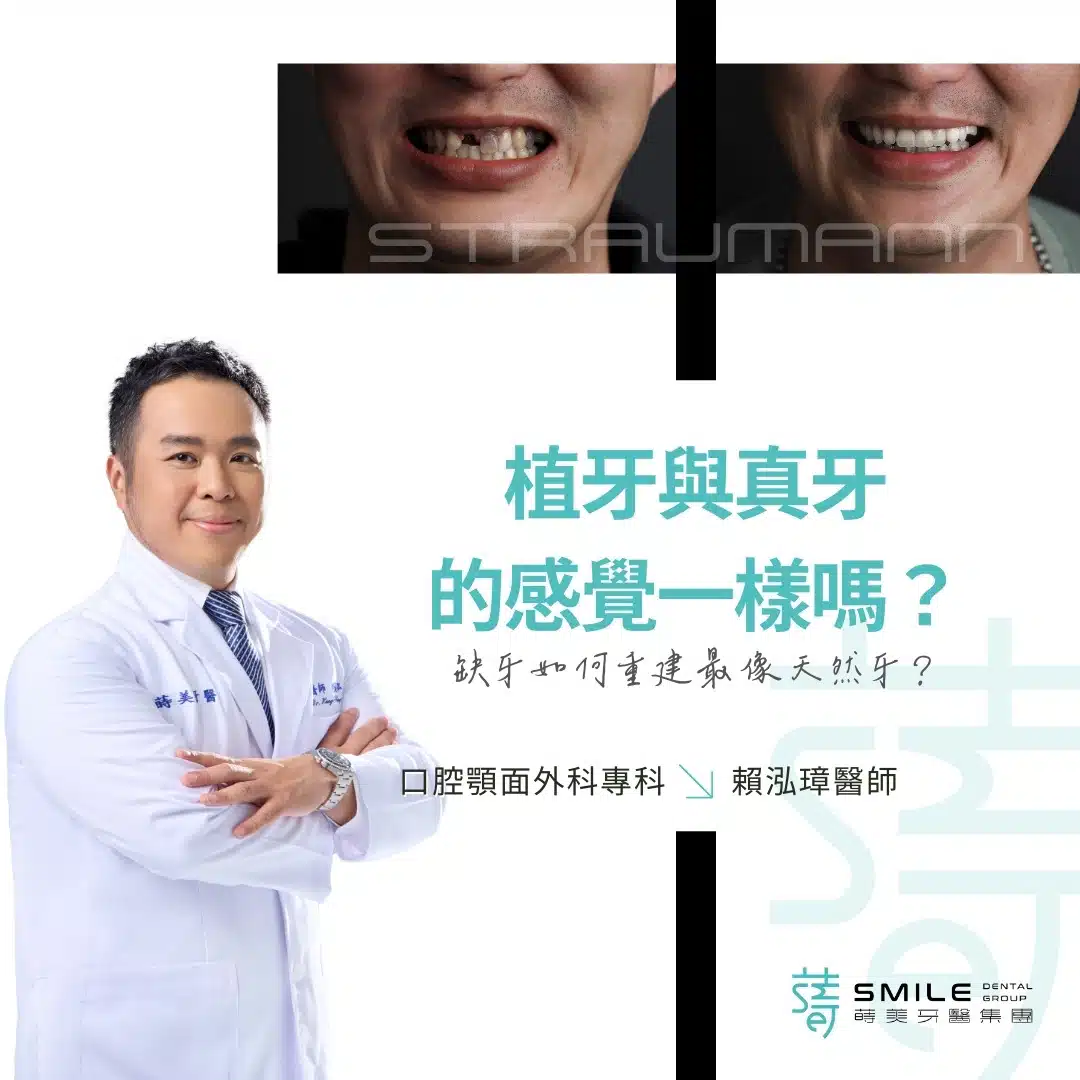 植牙與真牙 的感覺一樣嗎？