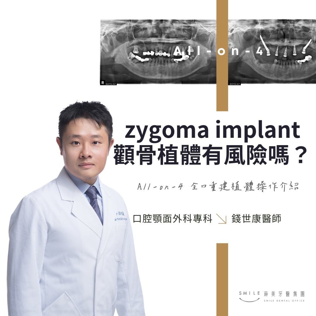 zygoma implant顴骨植體有風險嗎？