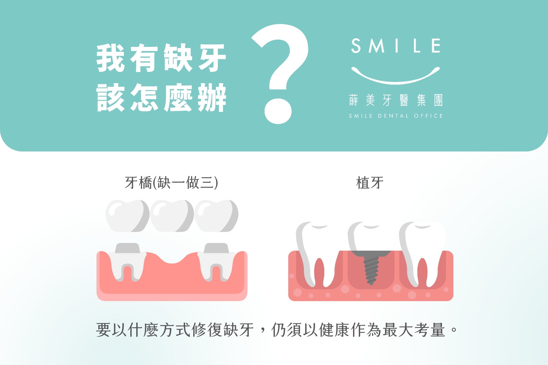 智庫-植牙有保固嗎? 缺牙、牙橋