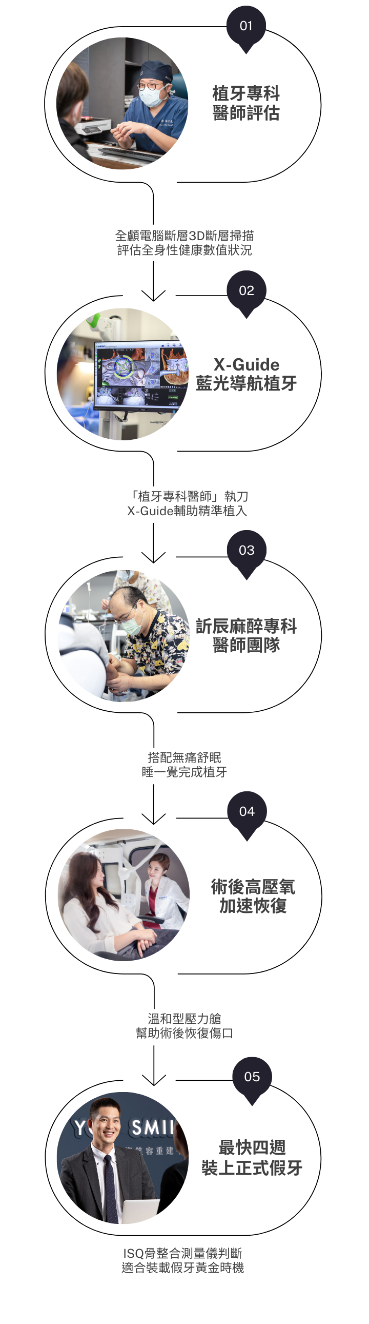 植牙步驟_mb (1)