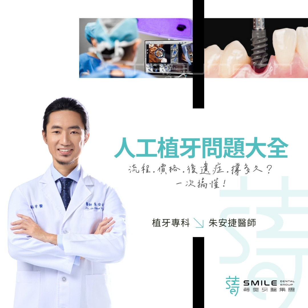 人工植牙問題大全
