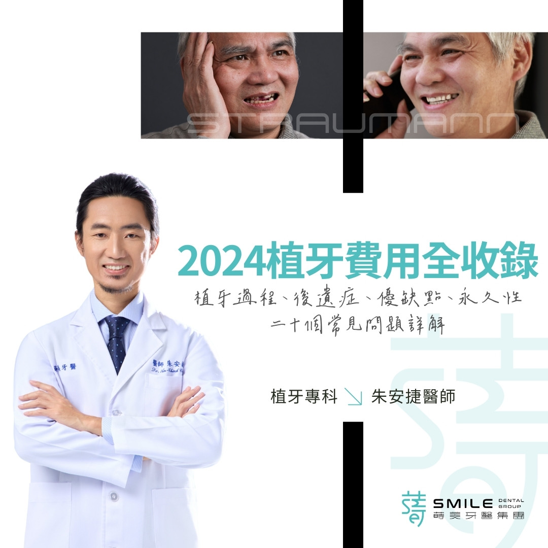 2024植牙費用全收錄