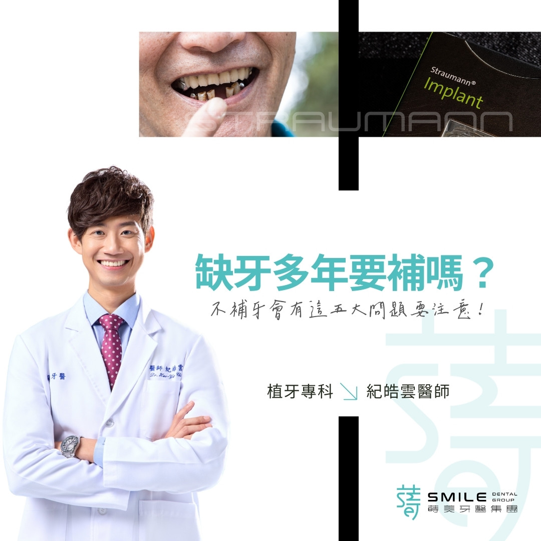 缺牙多年要補嗎？