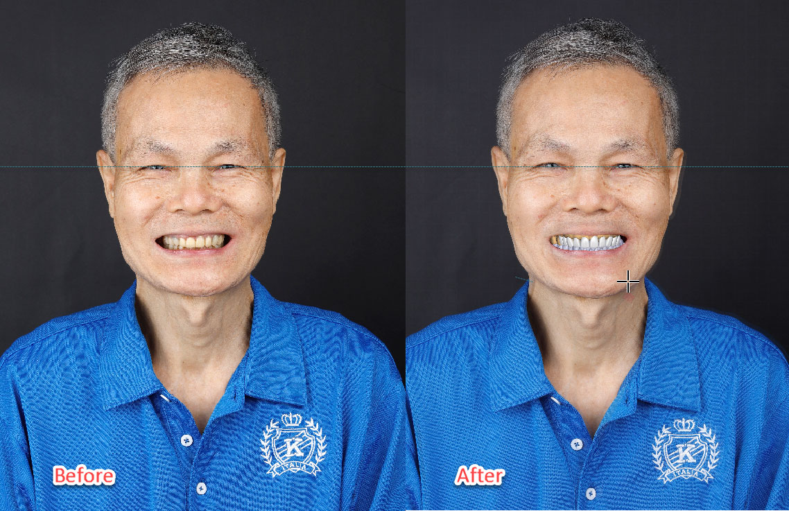 謝金堆before-after-(1)