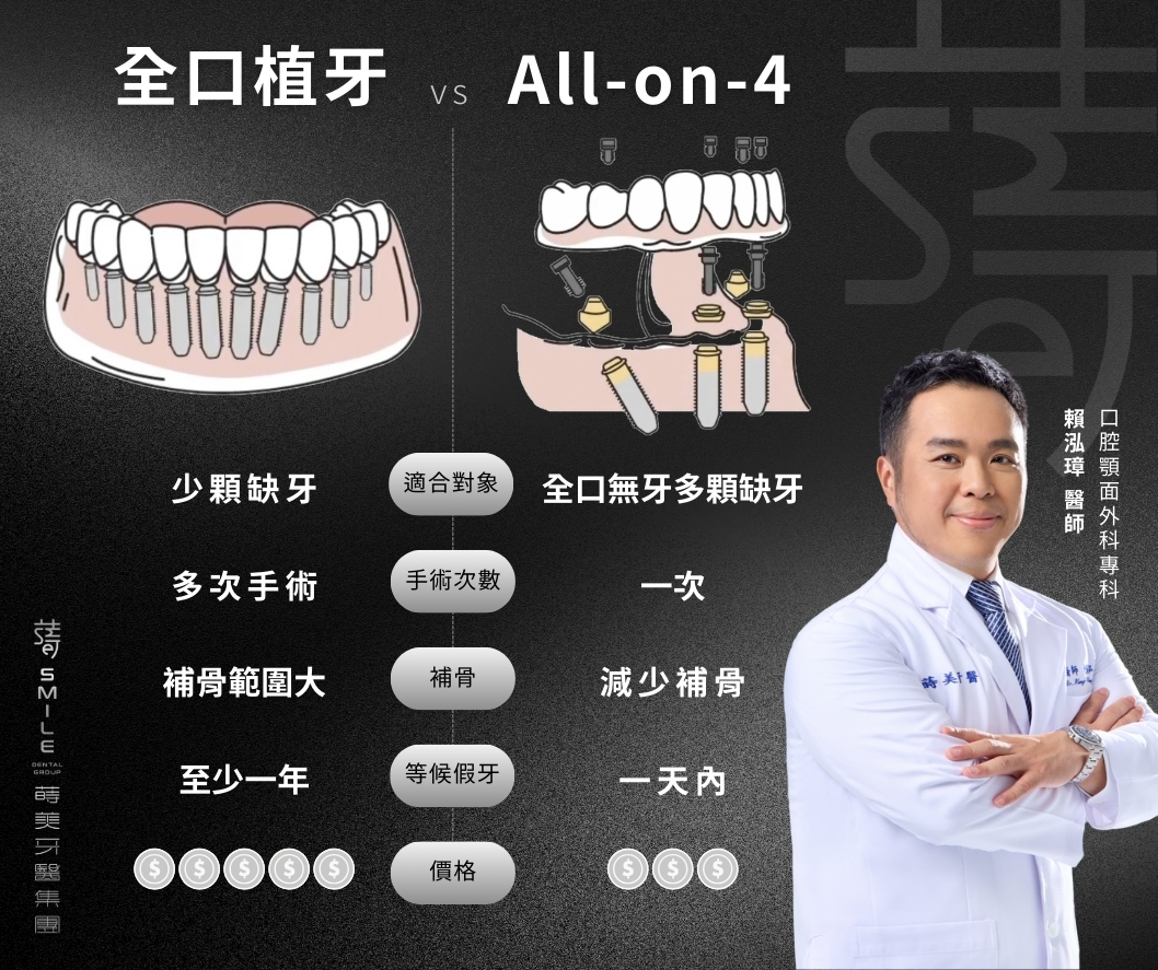 All-on-4 全口植牙 比較 差別