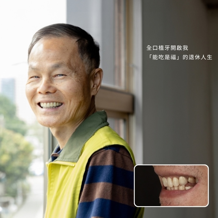 全口植牙開啟我「能吃是福」的退休人生