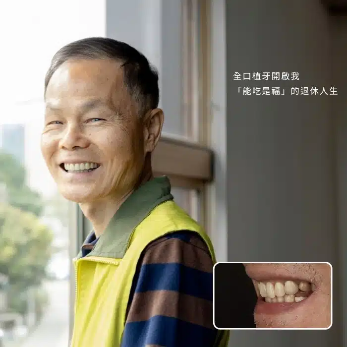 全口植牙開啟我「能吃是福」的退休人生