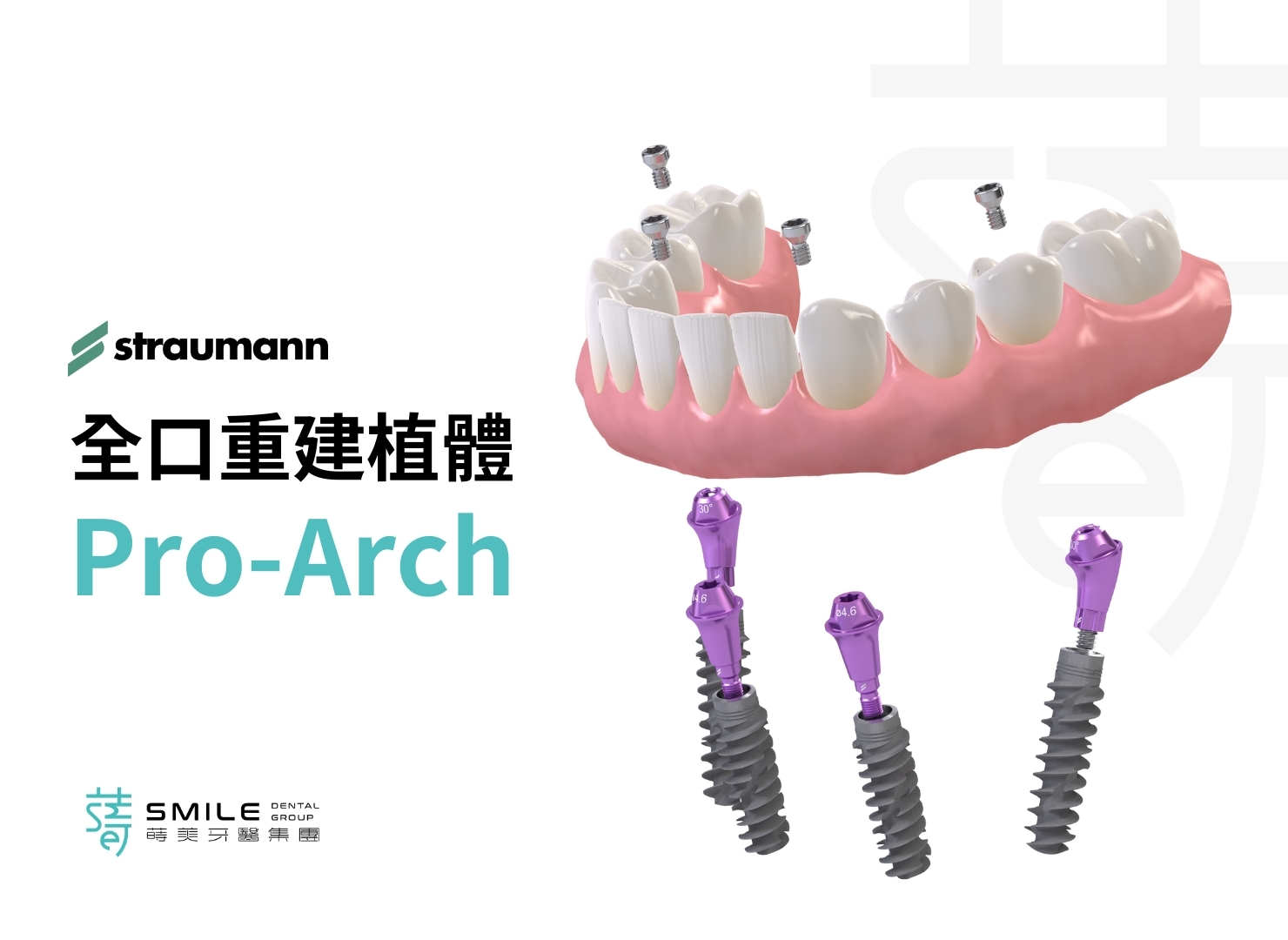 全口重建植體 Pro-Arch