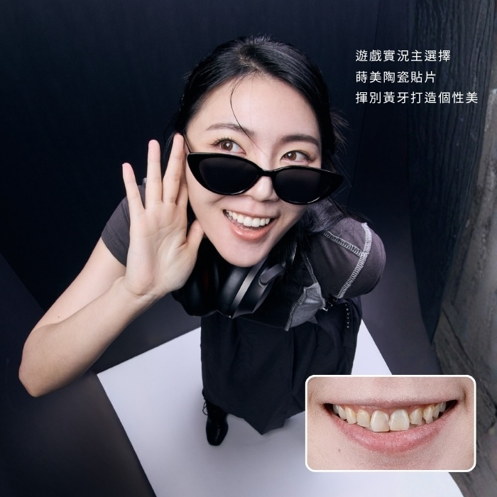 遊戲實況主選擇蒔美陶瓷貼片，揮別黃牙打造個性美