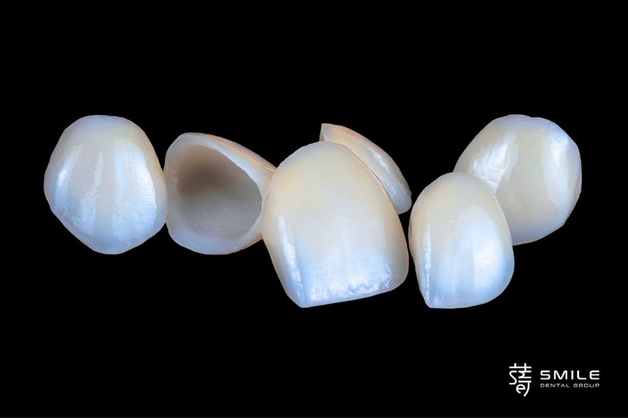 牙冠是什麼？牙冠套材質、種類、費用一次瞭解