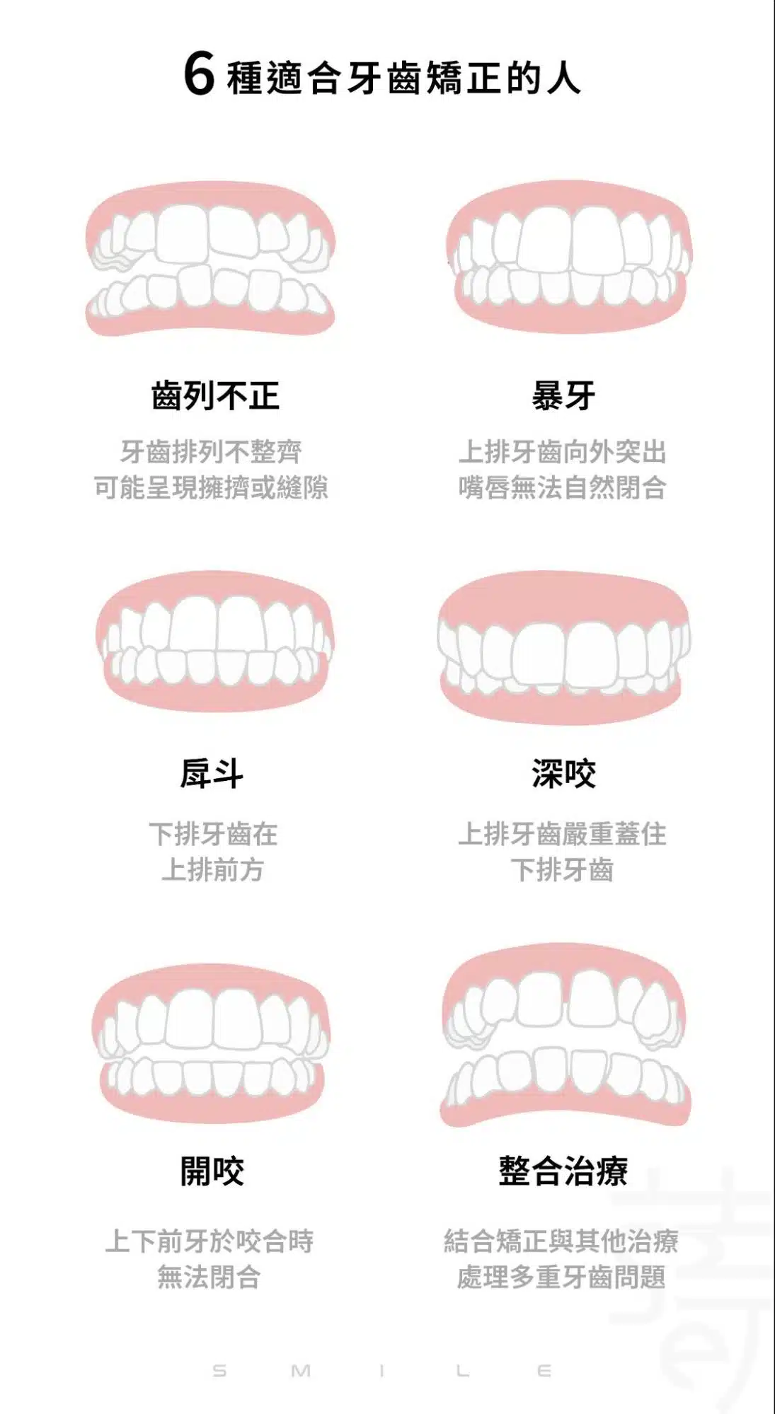 6種適合牙齒矯正的人