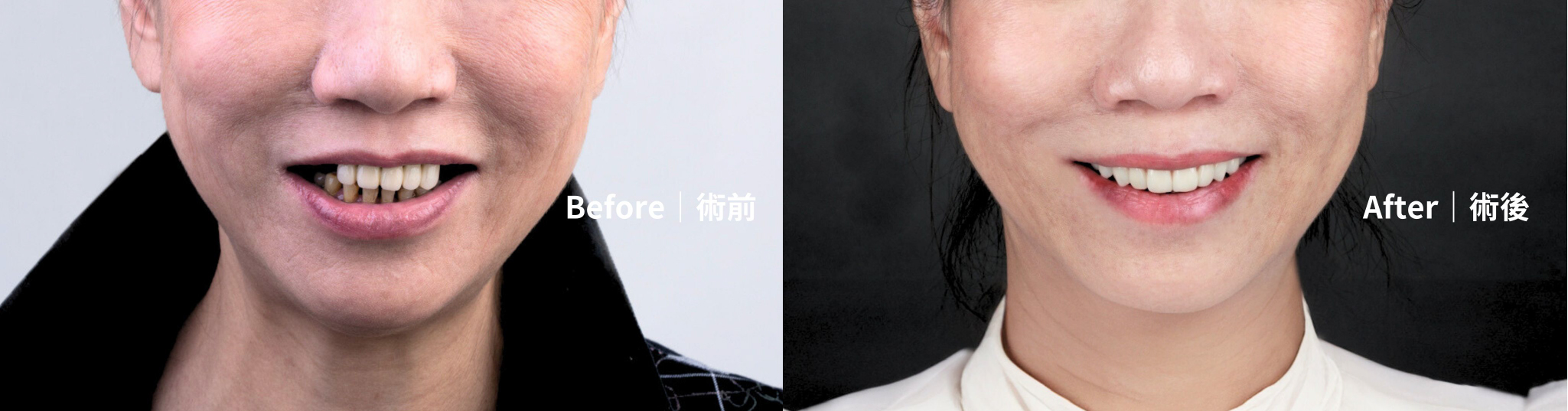 工作區域 1 複本 3-100