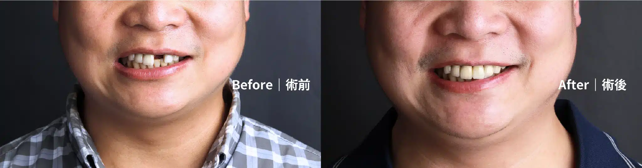 工作區域 1 複本 6-100