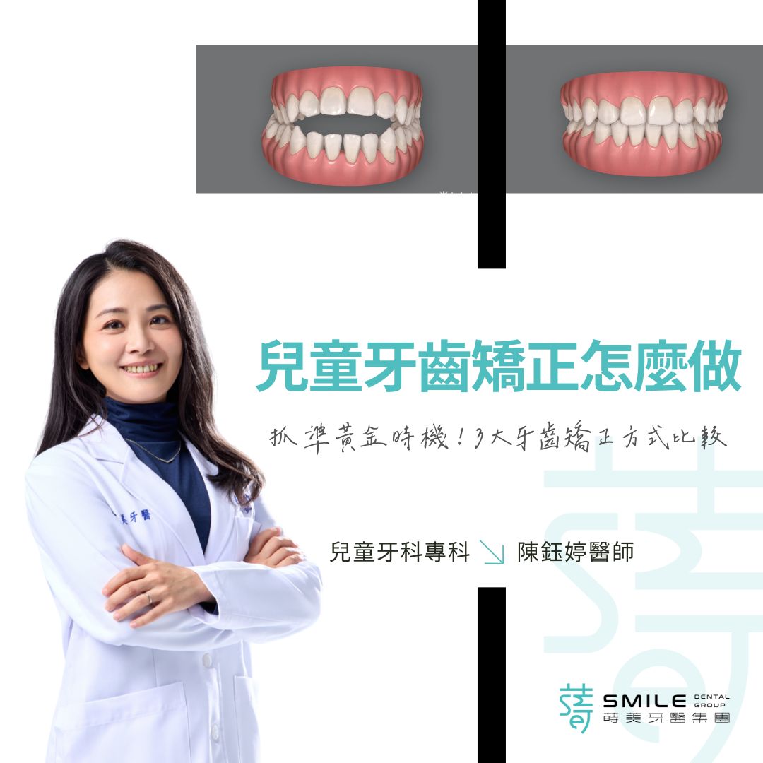 智庫/兒童牙齒矯正/兒童牙齒矯正怎麼做？抓準黃金時機！3大牙齒矯正方式比較