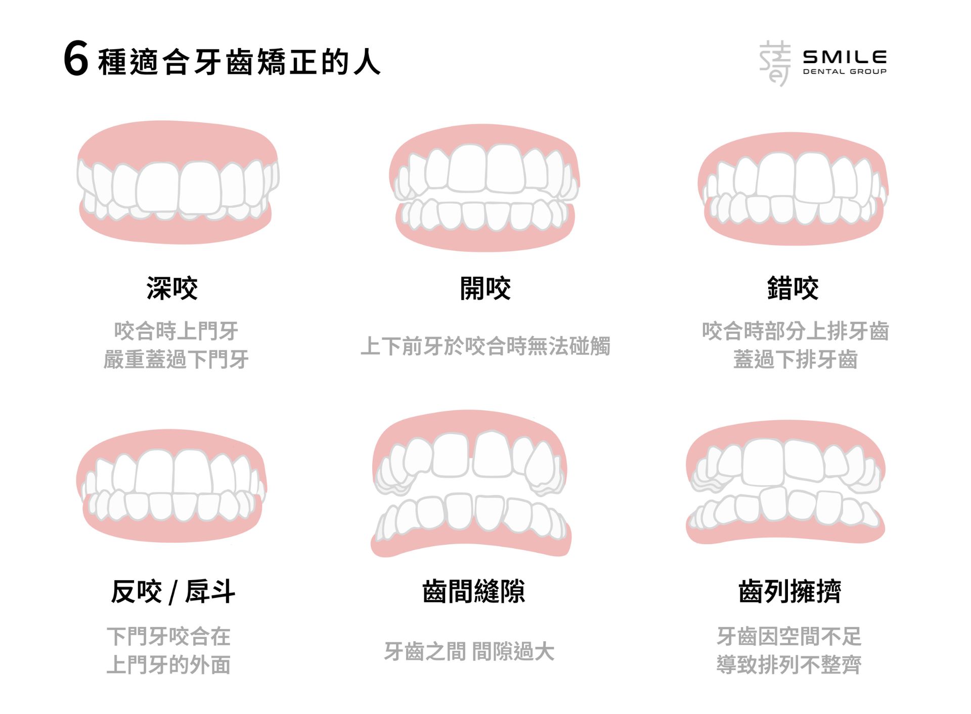 深咬是什麼？