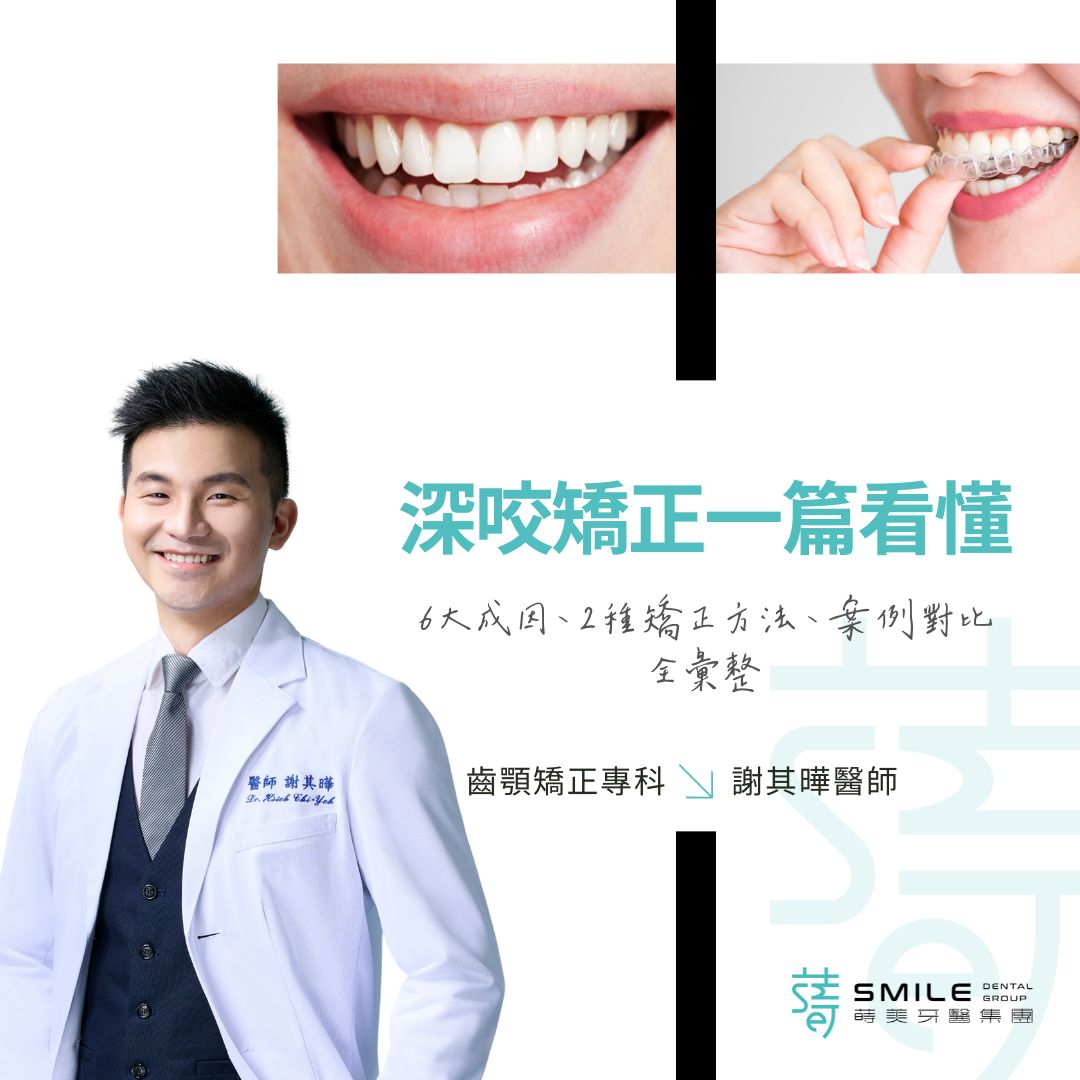 深咬矯正一篇看懂》6大成因、2種矯正方法、案例對比全彙整