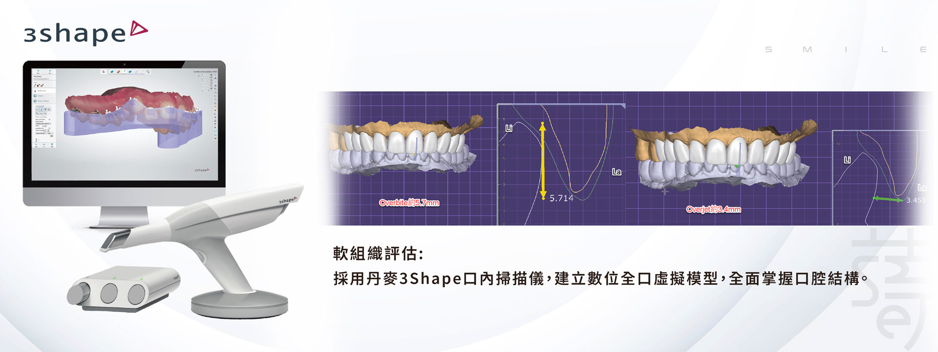 謝小姐一場意外改變了她的笑容植牙讓自信回來蒔美-3-shape-