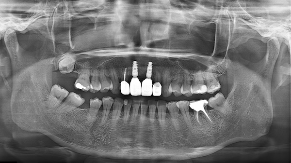 202503150303123961100326_000003960-2