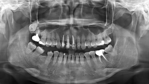 PX_STANDARD_20210707_184342-1