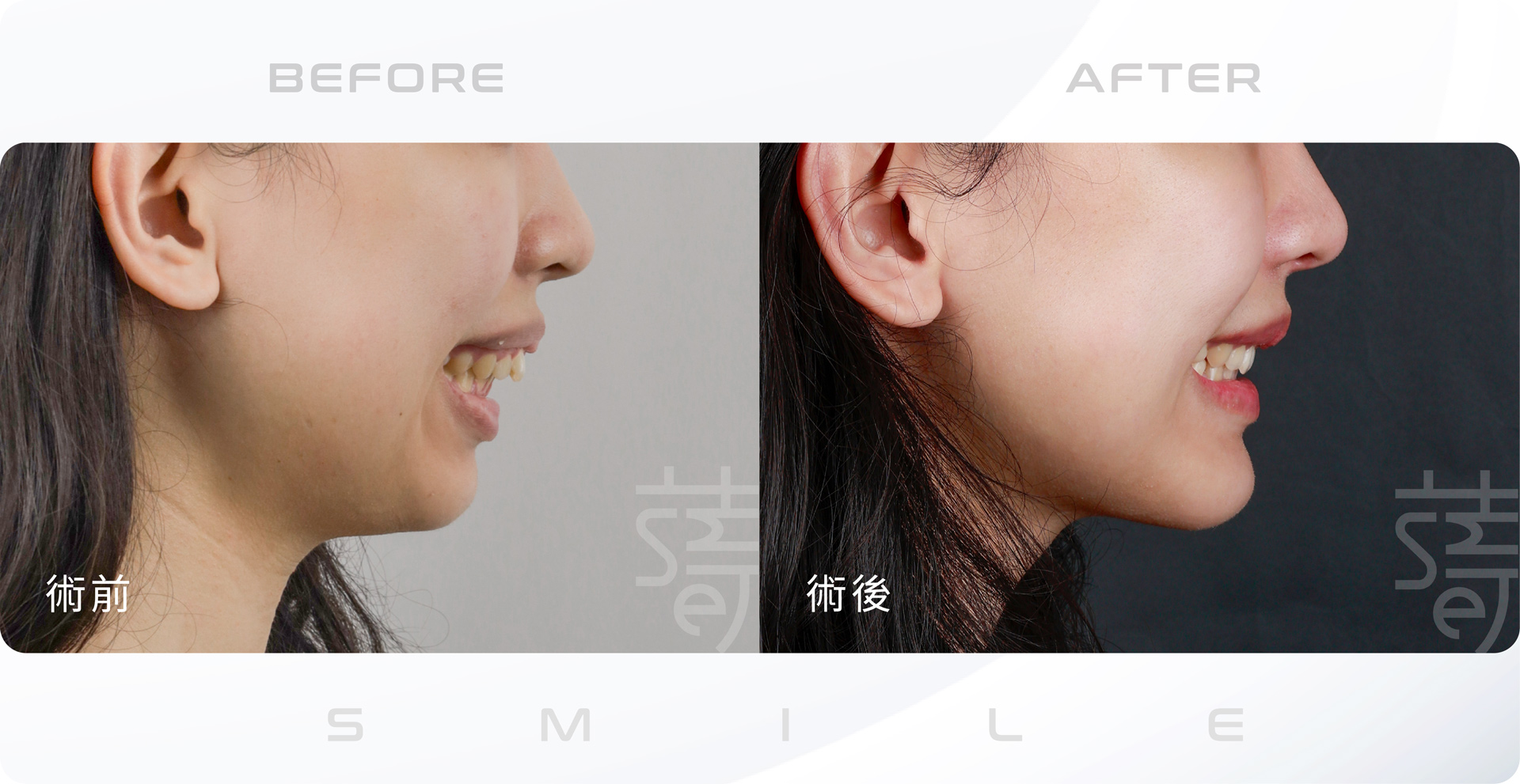 鄭力慈web-側臉笑