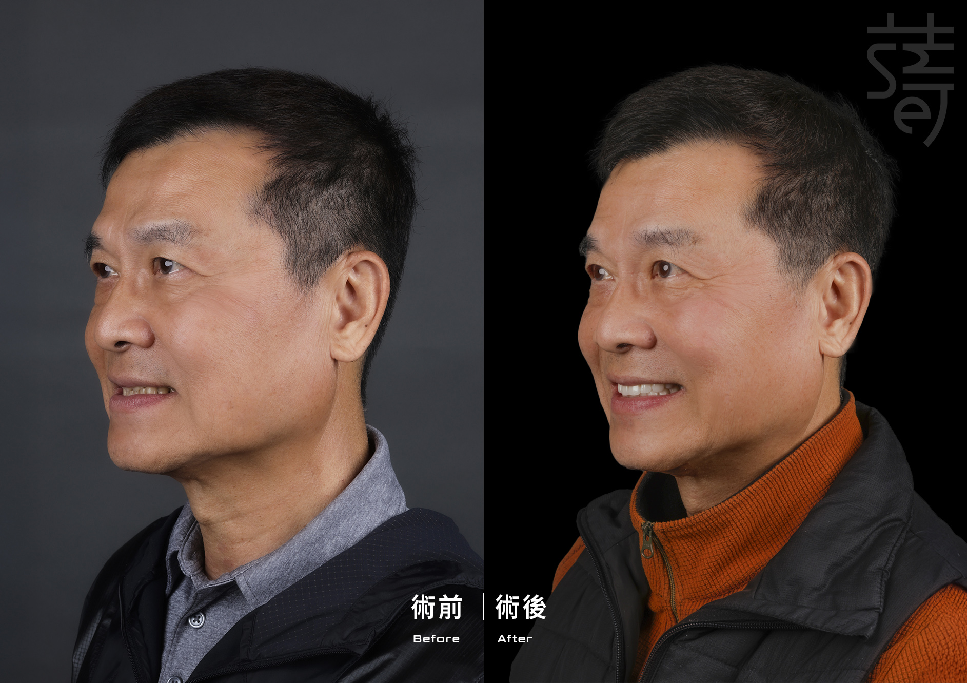 2 BA s 2_MG_0746.JPG 的