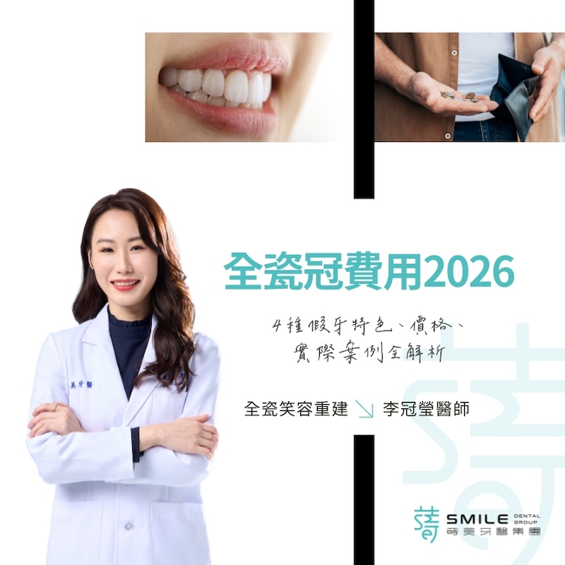 4種假牙特色、價格、實際案例全解析 全瓷冠費用2026