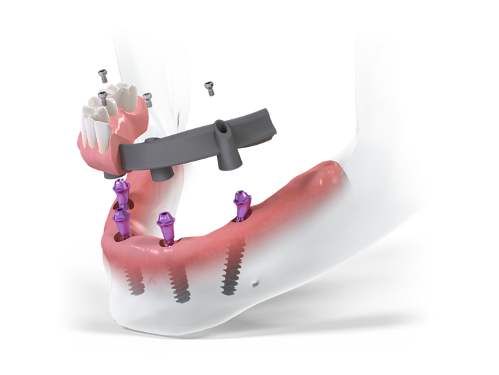 K0010_ProArch on4BLX SRB_RGB_Transparent_Padding