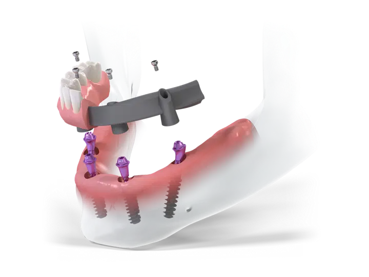 K0010_ProArch on4BLX SRB_RGB_Transparent_Padding