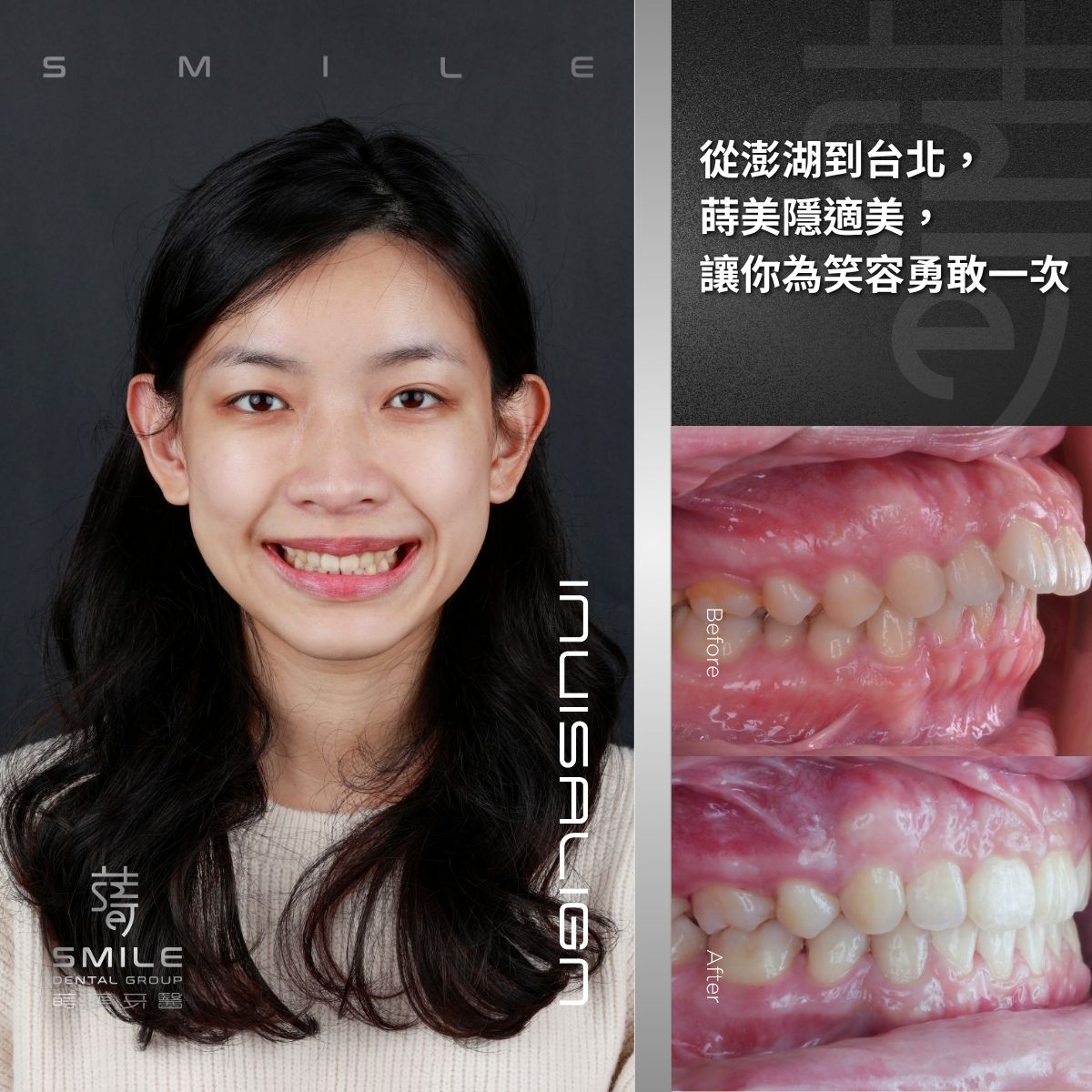 讓你為笑容勇敢一次