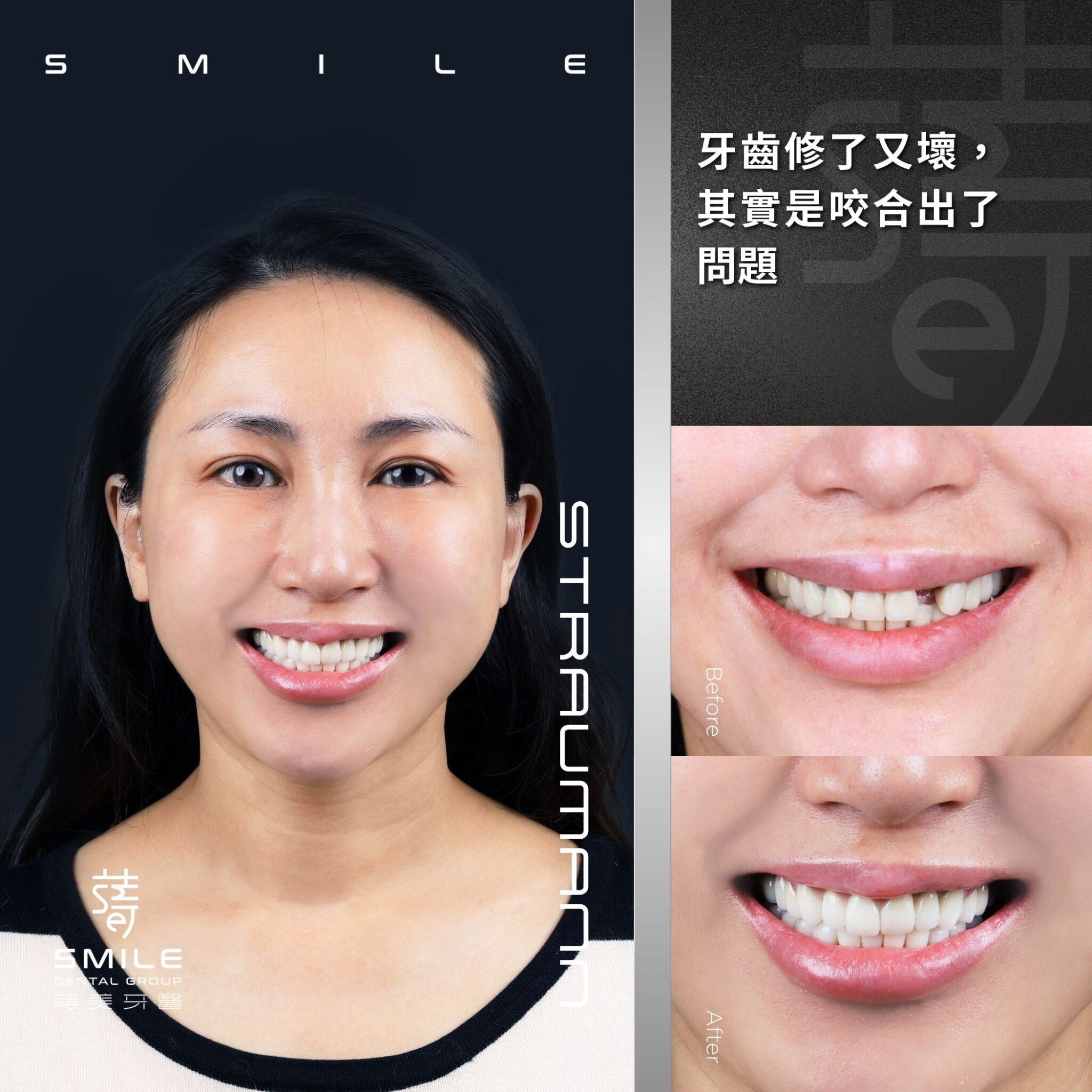 牙齒修了又壞，其實是咬合出了問題拷貝 (1)