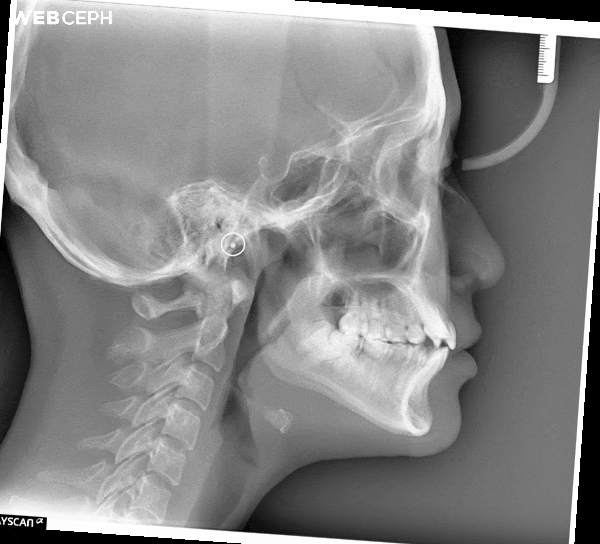 189H1O2D1_superimposition (1)