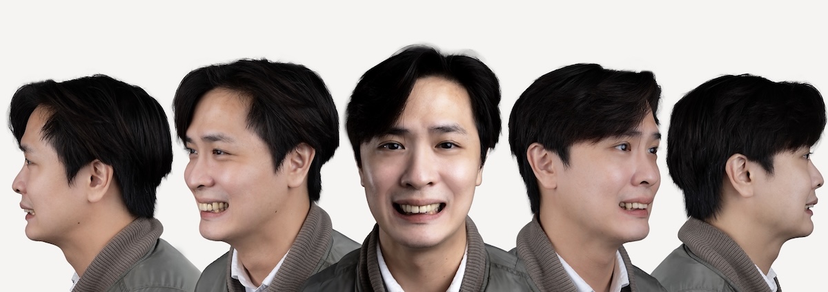 楊 五面圖術前-拷貝