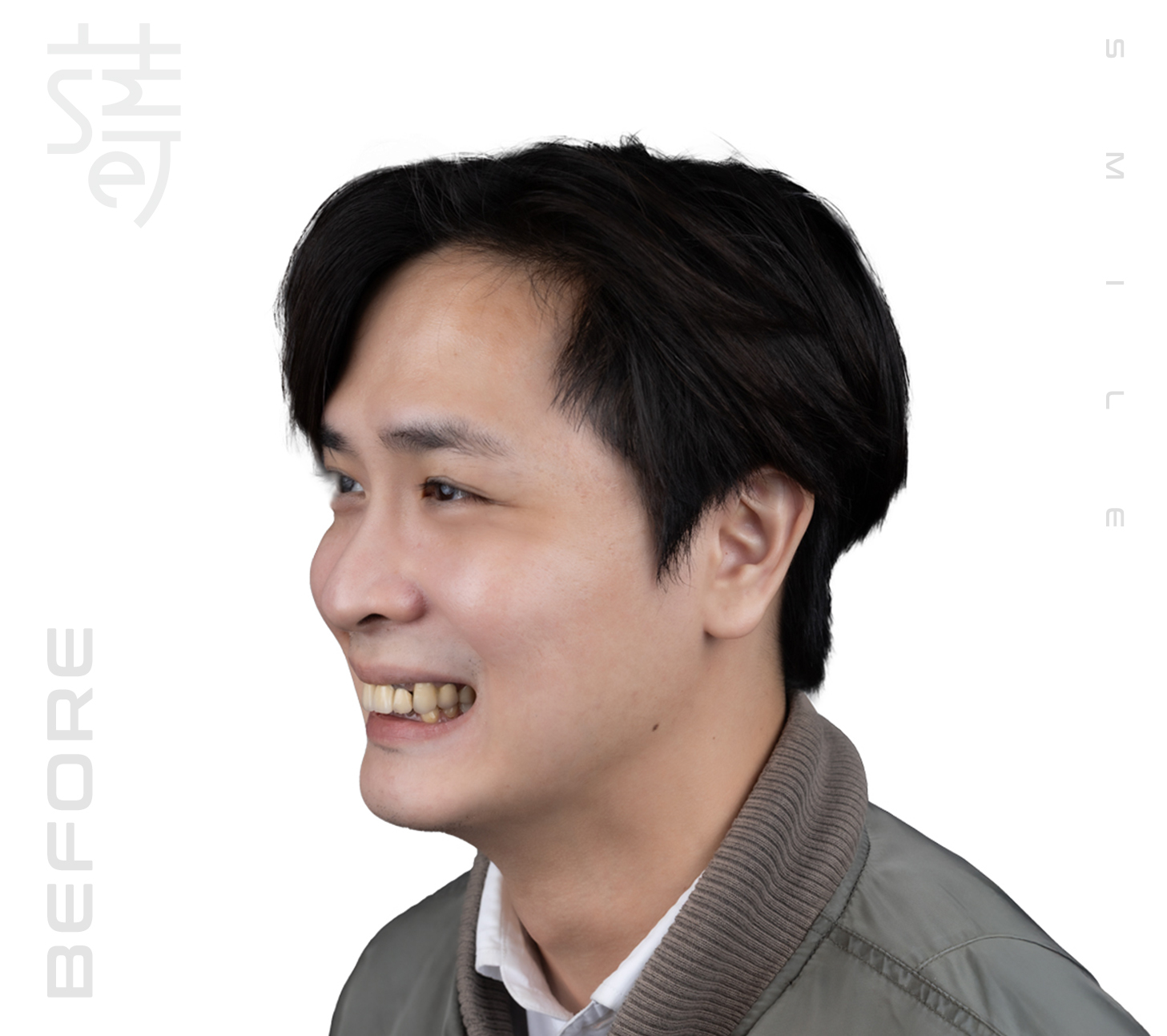 BA 延伸-2五面圖A2_MG