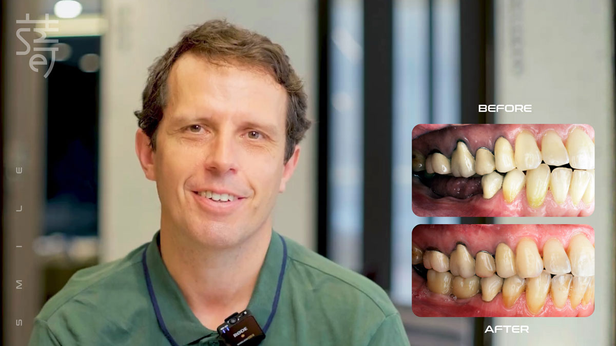 古亞文章用圖ba