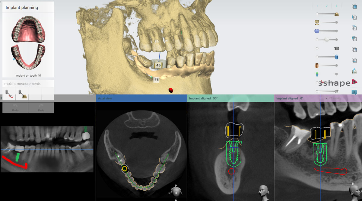 數位導板設計(1)