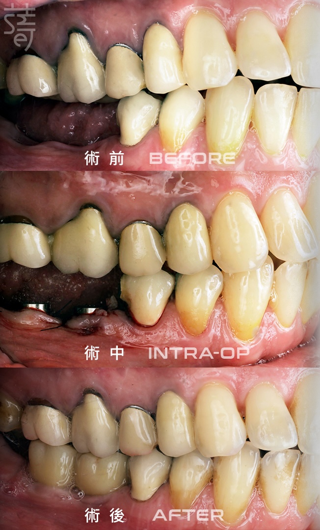 手機版本 3白色版 ba 拷貝