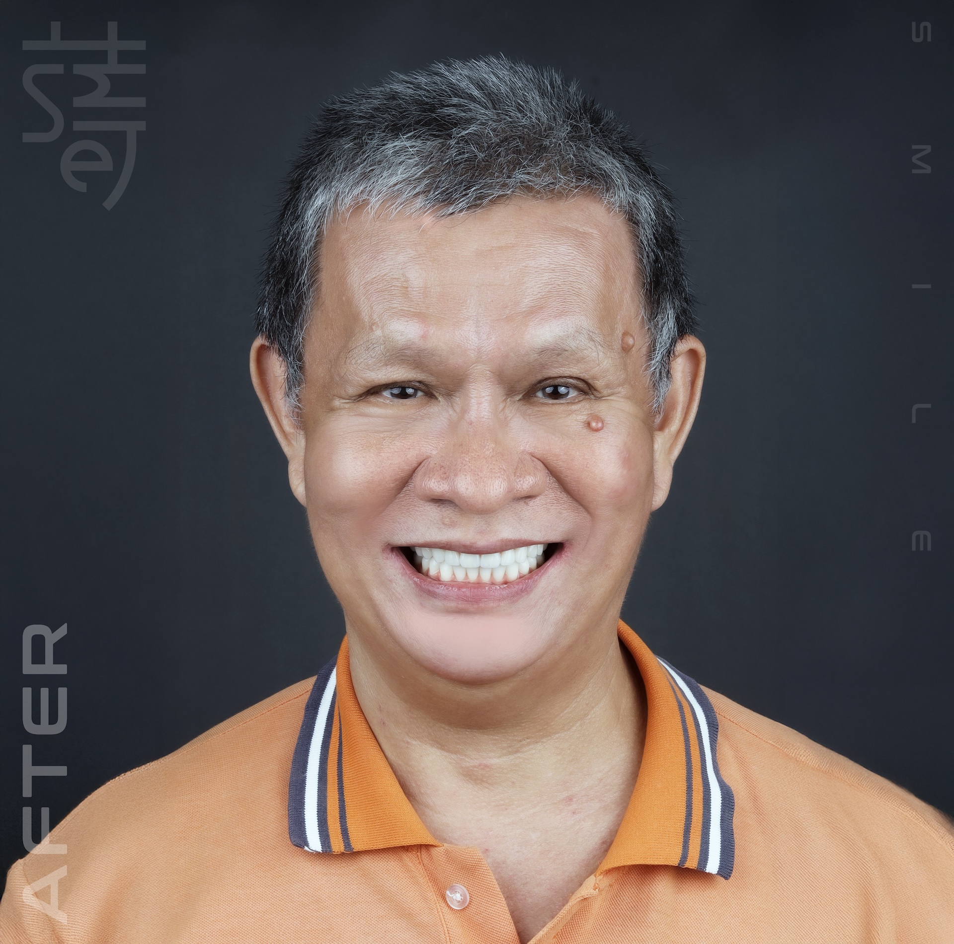 AFTER _MG_0036