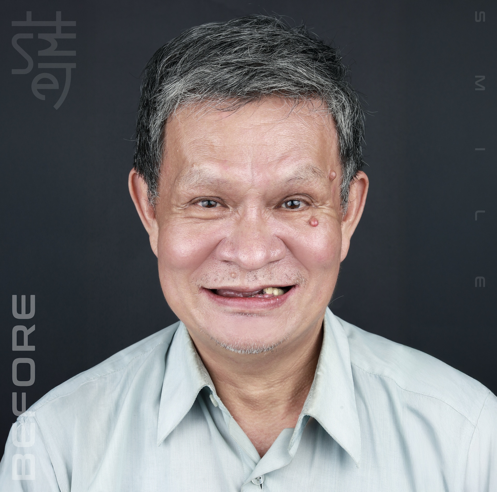 BEFORE _MG_0036